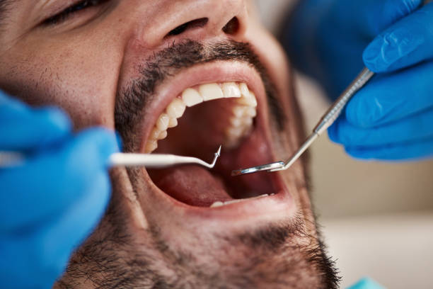 Best Laser Dentistry  in Buffalo, TX